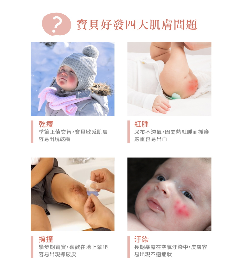 嬰兒霜